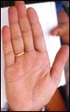 Shri Laloo Prasad Yadav